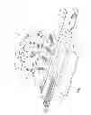 Fig. 04 - Stabilizing belt