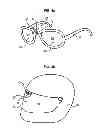 Fig. 06 - Adaptive optical filter