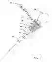 Fig. 02 - Surgical instrument tip cleaner