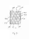Fig. 10 - Disposable premoistened multilayered cleaning wipe