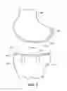 Fig. 03 - Implant device and method for manufacture