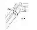 Fig. 04 - Bendable Measuring Device