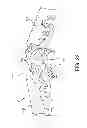 Fig. 20 - Rotationally molded snowplow assembly