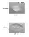 Fig. 08 - Pathogen resistant citrus compositions, organisms, systems, and methods