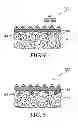 Fig. 04 - Structured abrasive articles and method of manufacturing the same