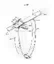 Fig. 19 - METHOD AND APPARATUS FOR HORSE BLANKET