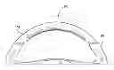 Fig. 01 - Steering wheel light bar