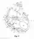 Fig. 17 - Electrical discharge system and method for neutralizing explosive devices and electronics