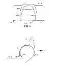 Fig. 05 - Back support for an inflatable boat