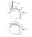 Fig. 09 - Back support for an inflatable boat