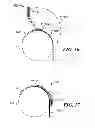 Fig. 10 - Back support for an inflatable boat