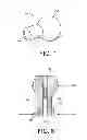 Fig. 05 - Pet toy with squeaker mechanism