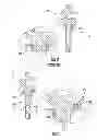 Fig. 04 - Timing belt pulley mounting and geometry for use in internal combustion engines
