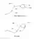 Fig. 16 - Aerosol delivery systems, compositions and methods
