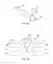 Fig. 24 - Aerosol delivery systems, compositions and methods