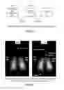 Fig. 32 - Aerosol delivery systems, compositions and methods