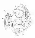 Fig. 04 - Respirator-Attachable Lamp Unit