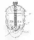 Fig. 01 - CPAP INTERFACE AND BACKUP DEVICES