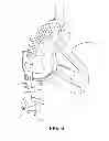 Fig. 13 - CPAP INTERFACE AND BACKUP DEVICES