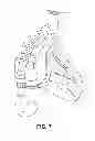 Fig. 14 - CPAP INTERFACE AND BACKUP DEVICES