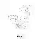 Fig. 16 - CPAP INTERFACE AND BACKUP DEVICES