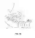 Fig. 21 - CPAP INTERFACE AND BACKUP DEVICES
