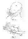 Fig. 03 - System and method for limited flow respiratory therapy