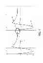 Fig. 04 - System and method for limited flow respiratory therapy