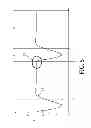 Fig. 06 - System and method for limited flow respiratory therapy