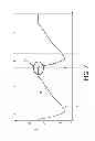 Fig. 07 - System and method for limited flow respiratory therapy