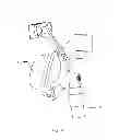 Fig. 02 - Adjustment assembly of respiratory mask