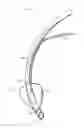 Fig. 01 - Endotracheal cuff and technique for using the same