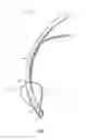 Fig. 02 - Endotracheal cuff and technique for using the same