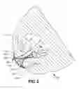 Fig. 03 - FEMALE CONDOM