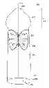 Fig. 01 - Polymeric articles comprising a decoration and method of manufacturing