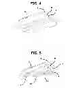 Fig. 03 - SEALED CAMOUFLAGED PIPE EMBEDMENT BUCKLE