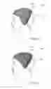 Fig. 07 - SEPARABLE WIG BASE ARRANGEMENT AND METHOD OF USE THEREOF
