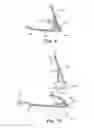Fig. 10 - Compact automated window washing apparatus