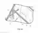 Fig. 20 - Compact automated window washing apparatus