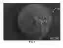 Fig. 02 - Porous Proppants