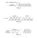Fig. 04 - System and method for steering in a downhole environment using vibration modulation