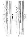Fig. 02 - REAMER TOOL POSITIONABLE IN A WELLBORE