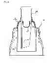 Fig. 04 - Apparatus for receiving heterogeneous materials