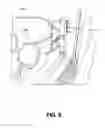 Fig. 07 - SHAKER TABLE WITH INERTIAL GAS/FLUID SEPARATION MEANS