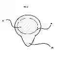Fig. 03 - Can Cover