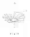 Fig. 04 - Container usable as a deep bottom and shallow bottom type container, and manufacturing method thereof