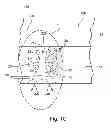Fig. 03 - Methods and apparatus for reduction of aerodynamic drag
