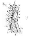 Fig. 08 - Apparatus and method for electrically insulating end turns of a stator assembly