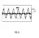 Fig. 03 - METHOD FOR DETECTING A ROTATION OF A ROTOR OF A GENERATOR