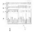 Fig. 07 - METHODS AND SYSTEMS FOR PROVIDING AUDITORY MESSAGES FOR MEDICAL DEVICES
